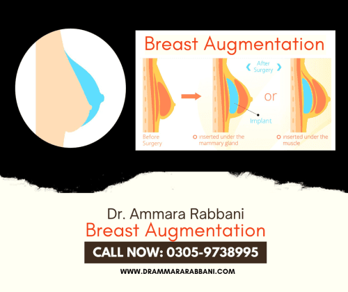 Breast different shapes Ahmed Ali Hassan, MD 